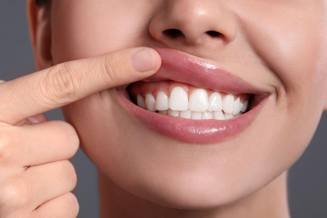 National Gum Care Month: What You Should Know About Gums, Gum Disease, and Prevention